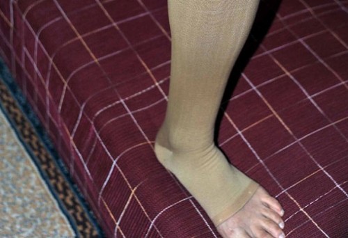 Varislere anında çözüm!