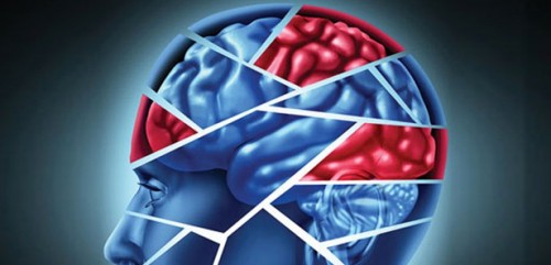 Huntington hastalığının tedavisinde umut ışığı