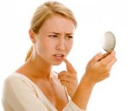 Uçuk nedeni bir "Herpes Simplex"