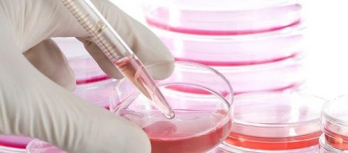 Türkkök Rekora Gidiyor