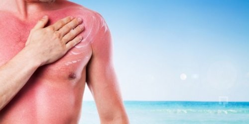 Güneşle gelen tehlike