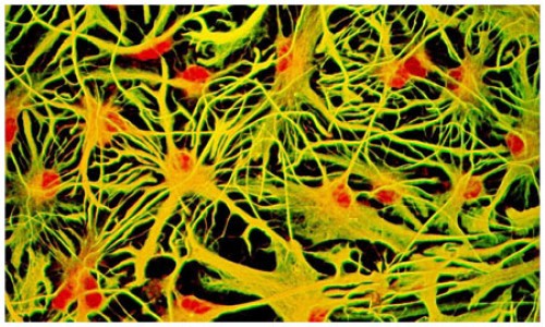 Şeker İlacı Beyin Hücresi Yapıyor.