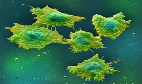 Türk profesör kanseri yendi