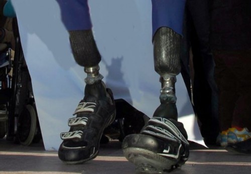 Düşünceyle kontrol edilen biyonik bacak