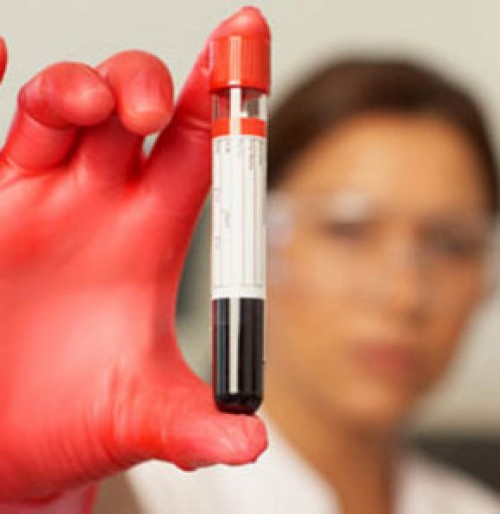 Kan grubun seni ele veriyor!