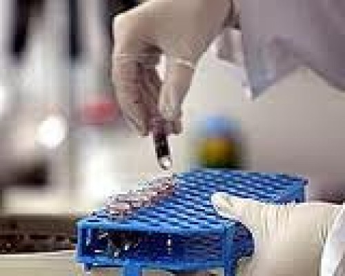 Ulusal kemik iliği bankası ‘TÜRKÖK’ geliyor