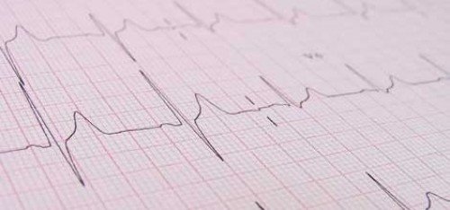 Kalp ritim bozukluğunda yeni takip sistemi