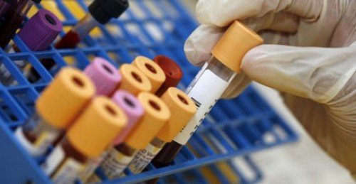 SGK sitesinde 6 liralık tahlil özel hastanede 36 lira oldu