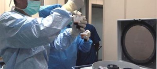 Kök hücre nakli hastalıksız yaşam süresini uzatıyor