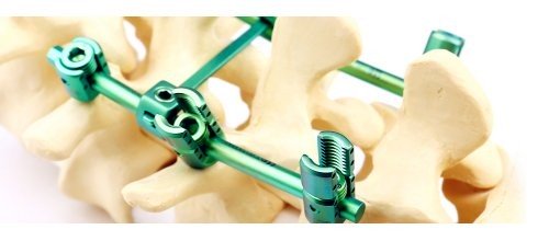 Platinden yeni bir omurga