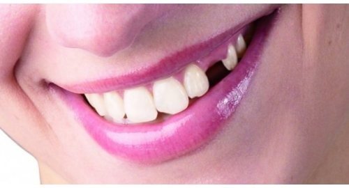 Dişlerin en büyük düşmanı