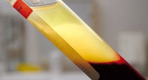 Dışa bağımlılığa son verecek ürün!