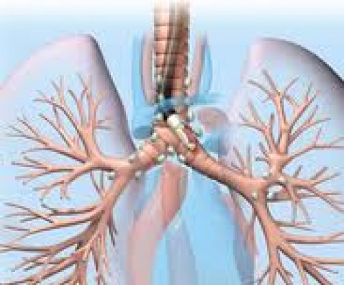 Akciğer kanseri teşhisinde ebus yöntemi