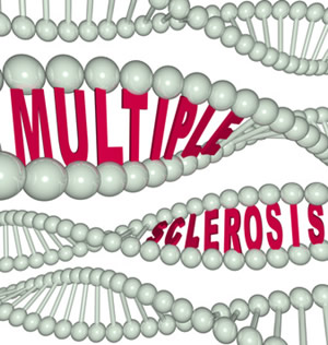  Multipl Skleroz (Emes Hastalığı) 