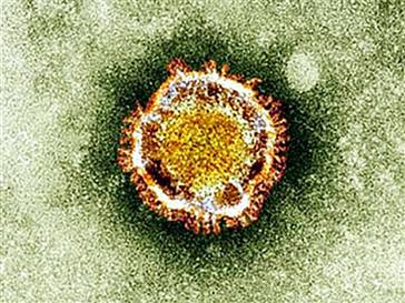  Corona virüsü tanımlandı 
